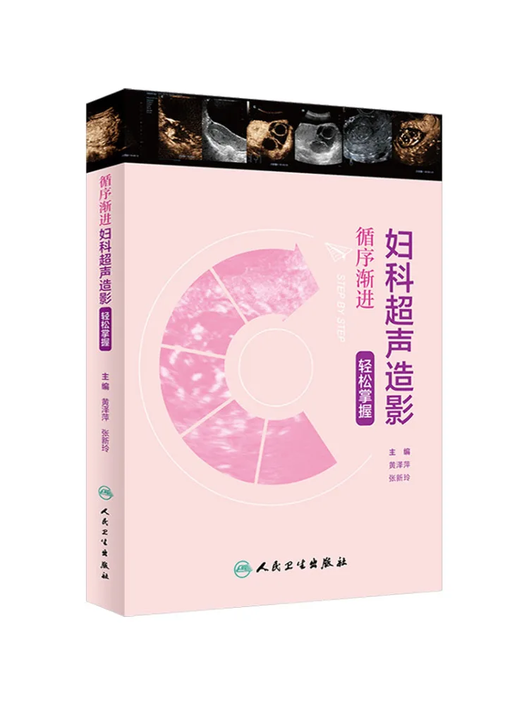 

Book-Winshare Step By Step Гинекологическая ультразвуковая визуализация легко работать