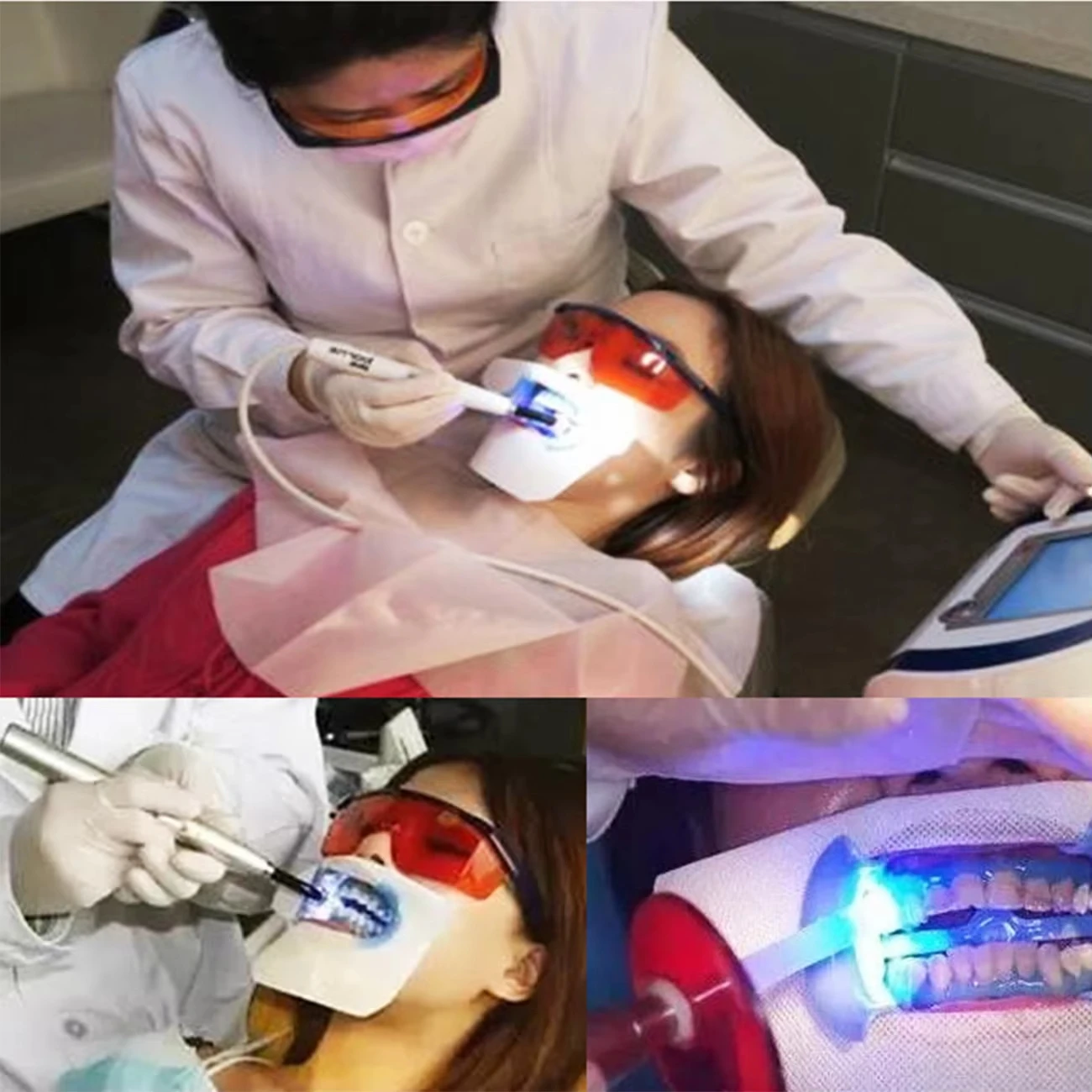 1 قطعة 12 مللي متر دليل علاج الأسنان قضيب الألياف البصرية نصائح للأسنان LED علاج ضوء مصباح تبييض الأسنان المزيد من أنواع معدات طب الأسنان #6