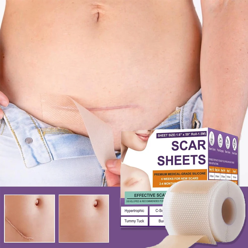 

Silicone Waterproof Scar Acne Weakened Stickers Treatment Removal Tape Trauma Burn Scar Cover Skin Repair Damaged Skin Protect