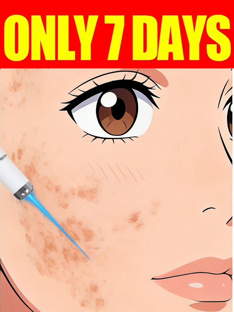 

Многофункциональная ручка-щетка UPgrade ht2026 с синим светом для очищения кожи лица от меланина, инструмент для удаления меланина с лица, широко применимый.