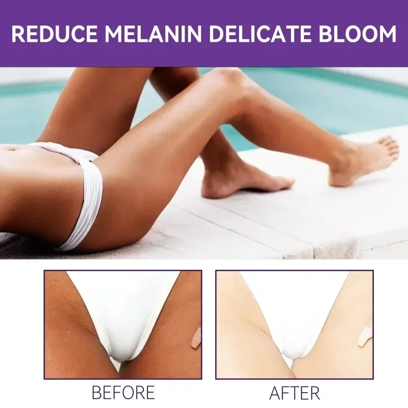 Crema schiarente per il corpo delle donne Parti intime Dissolvenza Emulsione della pelle scura Interno coscia Ascelle Siero sbiancante Illumina i glutei Creme