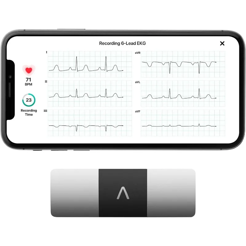 

KardiaMobile 6-Lead Personal EKG Monitor Six Views of The Heart Detects AFib and Irregular Arrhythmias Instant Results