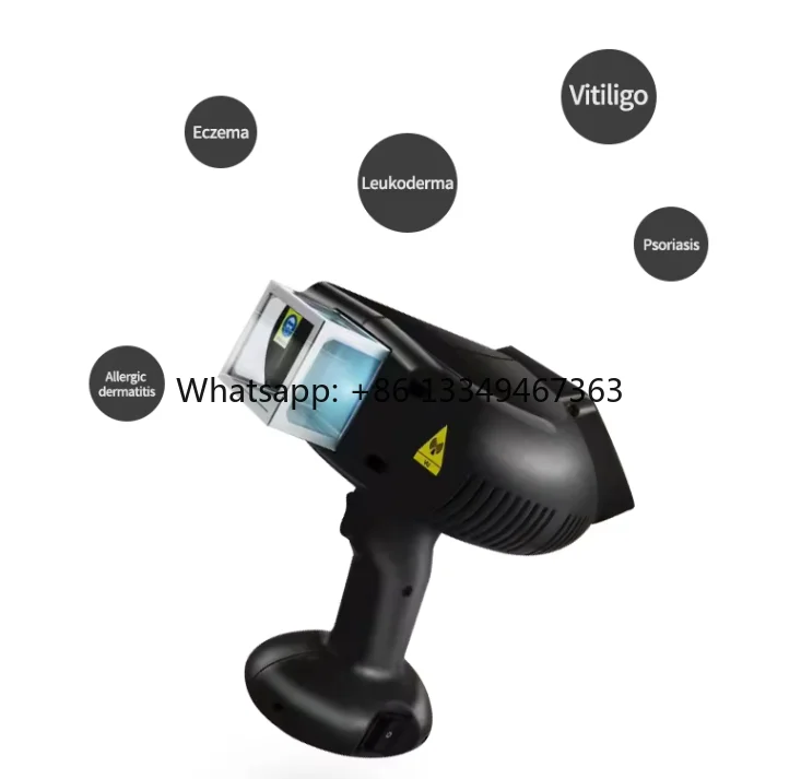 

Trending Products New Arrivals 308nm Excimer Light Therapy Dermatology Diseases Vitiligo Psoriasis Treatment Machine factory