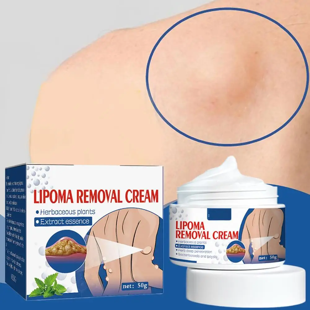 

Lipoma Removal Cream Lipolysis Fat Lump Relief Cream Skin Swelling Fat Elimination Cream 50g Health Care