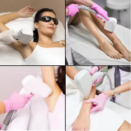 Máquina de depilación láser de diodo portátil 808NM 3000W 3 longitud de onda 755NM 808NM 1064NM depilación permanente indolora de cuerpo completo