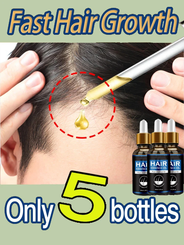 

Anti Hair Loss Scalp Treatment Serum Beauty Health Products Fast Hair Growth for Men Women Ginger Oil Care