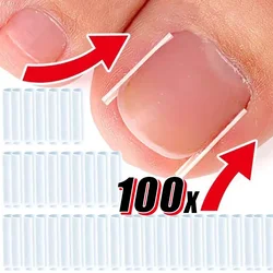 Elastic C-shaped Tube Pad for Toe Nail Ingrown Toenail Corrector Tools Foot Care Invisible Groove Straightening Clip Treatment