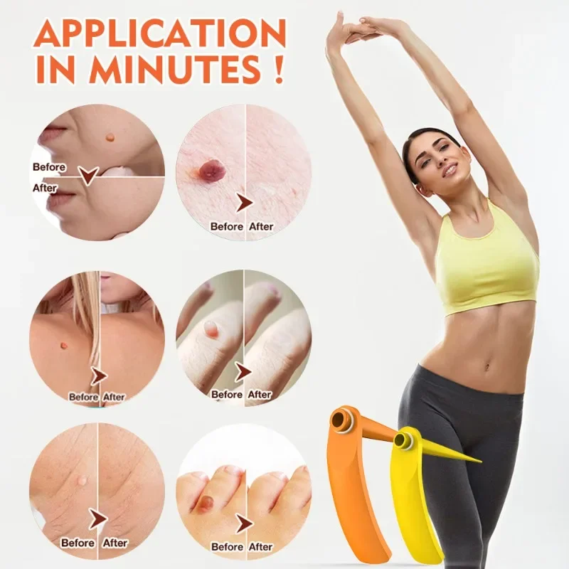 

2 в 1 для удаления родинок на коже, меток и бородавок. Работа просто и эффективно для удаления набора инструментов. Полный набор новых.