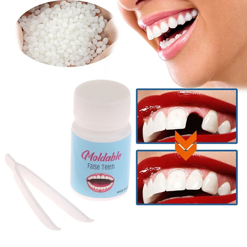 Sdatter New Resin Tooth Repair Kit 5g/10g/15g/20g FalseTeeth Gaps Temporary Teeth Solid Glue Denture Adhesive Teeth Whitening To