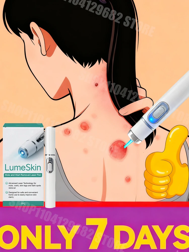 41 جيل من الثآليل المطورة جذر الثآليل الإصلاح uickly A55 #1