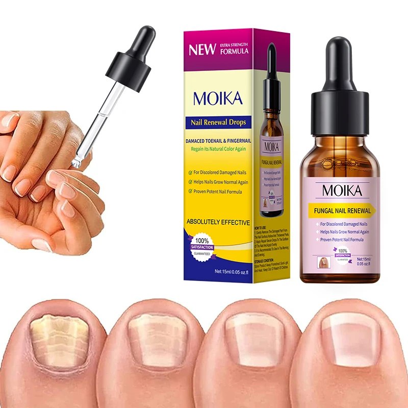 

MOIKA Fungal Nail Treatmen Serum Foot Nail Fungus Removal Gel Anti-Infection Repair for Paronychia & Onychomycosis Nail Care