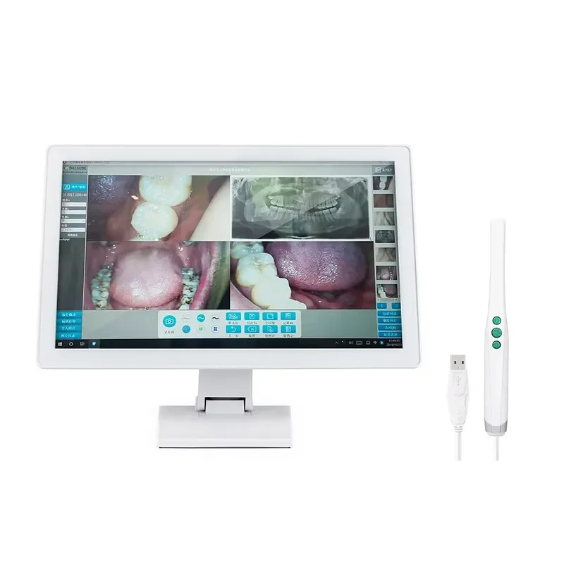 Hot Sale WIFI Intraoral LED Endoscopic Cameras with Monitors and Metal Stand Electric Power Source Medical Belt