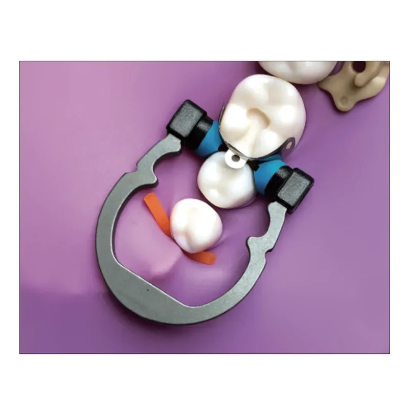 حلقة لقط زنبركية للأسنان من Niti R5 1.0 تيتانيوم صغير/أزرق متوسط/برتقالي مرونة جيدة أطراف نظرة خاطفة مواد تقويم الأسنان #2