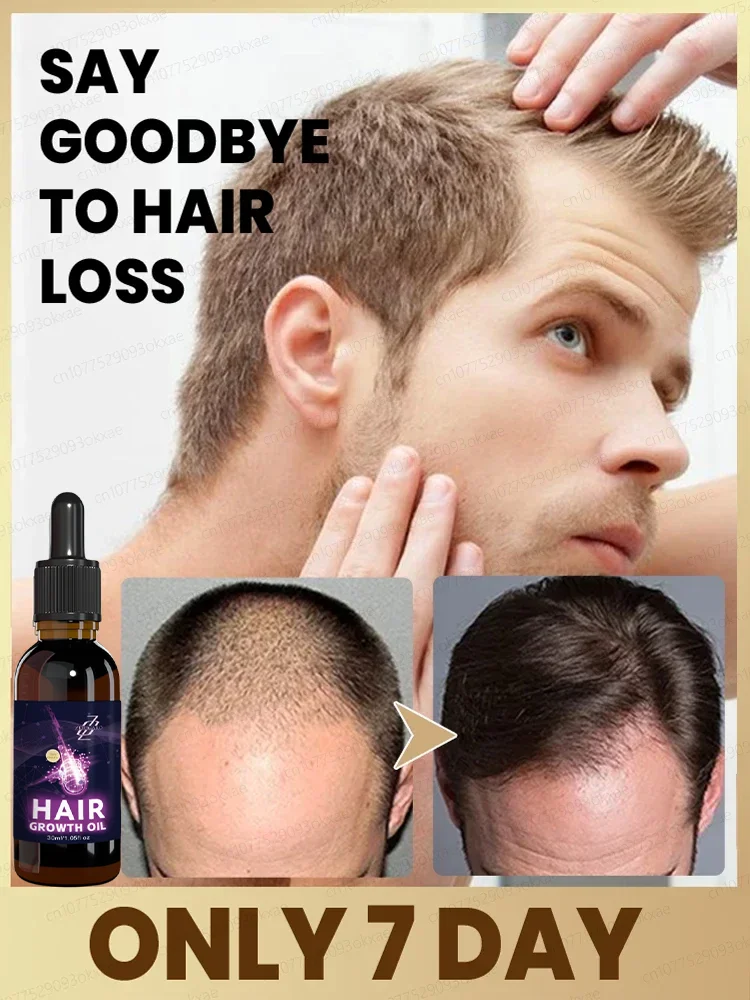 Tʜᴇ ʟᴀᴛᴇsᴛ ʜᴀɪʀ ɢʀᴏᴡᴛʜ ᴇssᴇɴᴛɪᴀʟ ᴏɪʟ ɪɴ 2024, ᴇғғᴇᴄᴛɪᴠᴇʟʏ ʀᴇᴘᴀɪʀs ʙᴀʟᴅɴᴇss