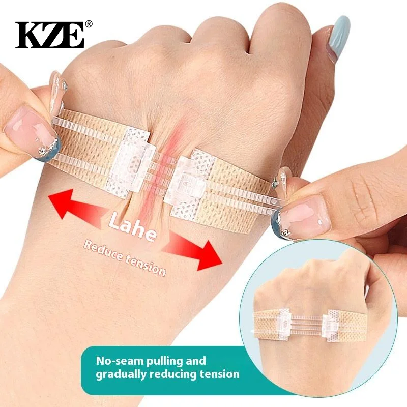 سستة التعادل الجرح إغلاق التصحيح مرقئ التصحيح الجرح سريع دون خياطة سستة في الهواء الطلق الفرقة المعونة المحمولة جلطة سريعة الجرح