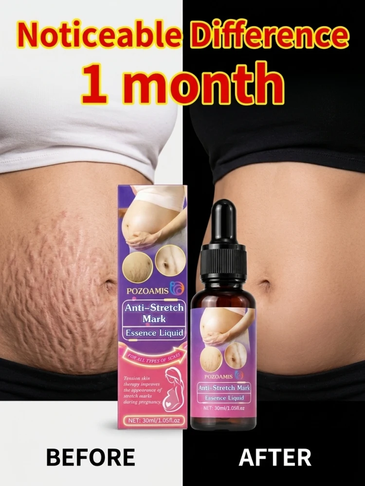 Body Skin Nourishing Essence for Stretch Marks & Scars, Hydrate Dry Coarse Skin, Soften Uneven Skin Look, Daily Massage Oil for Abdomen & Body Skin Care