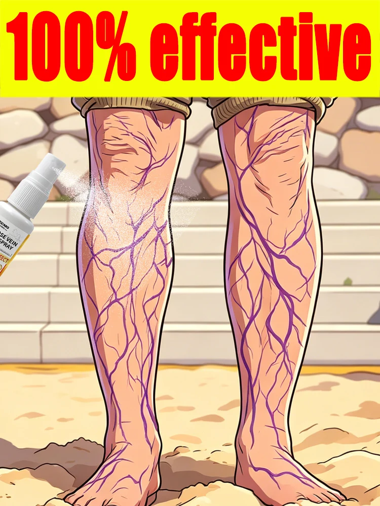 

Latest liquid technology helps improve varicose veins