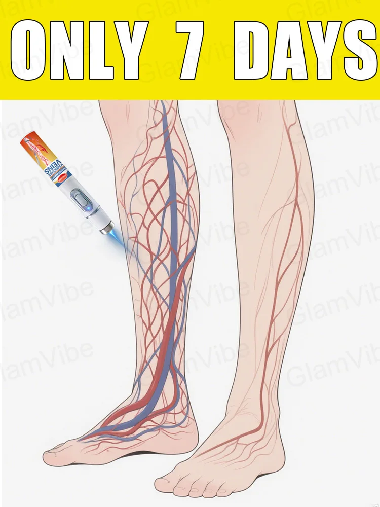

blue light pen solve varicose veins, hot sale leg care tools