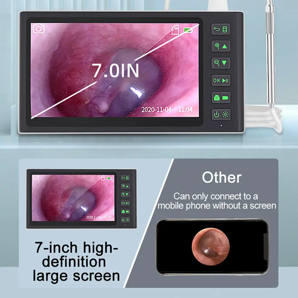 Imagem -03 - Otoscópio Digital com Tela Lcd de Polegadas Câmera Endoscópio Oral 1080p hd 1080p Ferramentas de Home Care