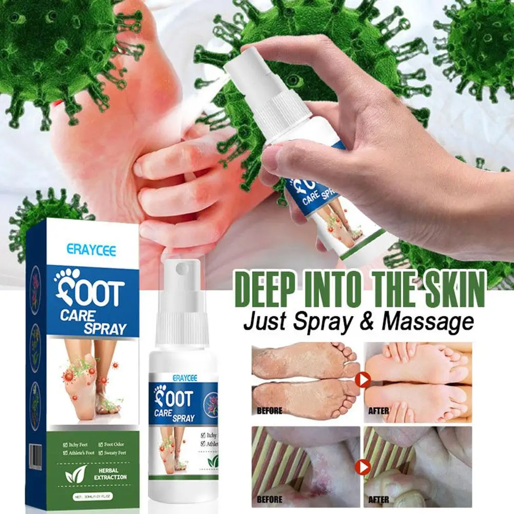 30ml Foot Deodorant Spray Relieve Itching Eliminate Odor Athlete\'s Of The Foot Care Foot Anti-Sweat Removal Spray Moisturiz K1Z0