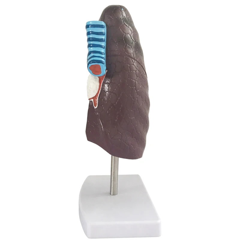 Human Lung Anatomical Model Smoker's Tuberculosis Pathological Lung Model Medical Research School Teaching aid