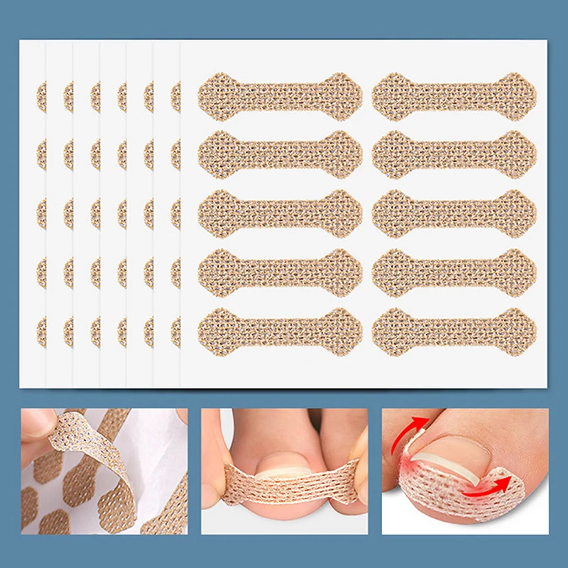 10pcs/Sheet Orthodontic Nail Patch Ingrown Armor Grow Into Flesh Toe Pad Manicure Patch Orthosis Skin Friendly Breathable