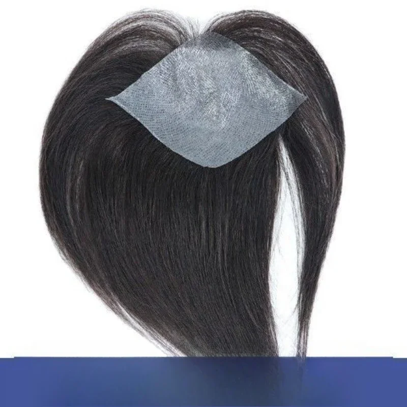 Reissue wig patch men and women invisible and seamless hairline alopecia areata biological top scalp area