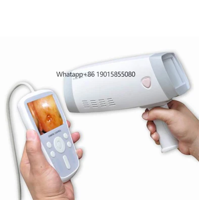 

YSPL9800B Ysenmed Handheld Electronic Portable Gynecology Colposcopy System Digital Electronic Gynecology Video