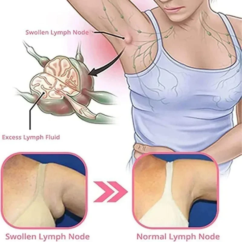 1 Paar Vrouwen Behandeling Met Germanium Gewichtsverlies Oorbellen Lymfedrainage Oornagel Magnetische Therapie Germanium Oorbellen