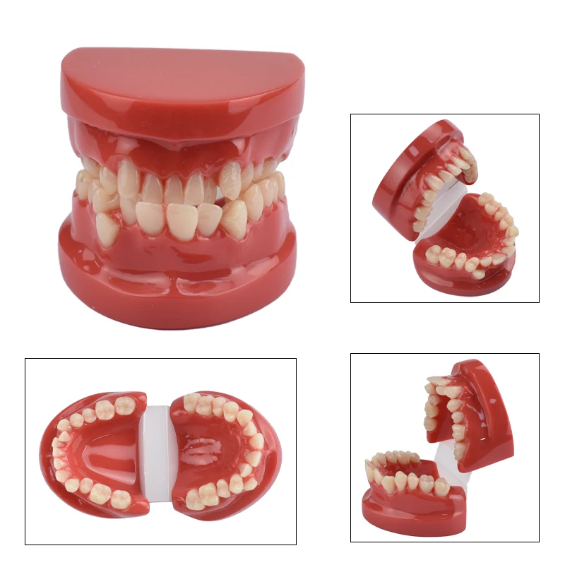 

Dental Resin Teeth Model Dental Teeth Malocclusion Model for Dentist Students Practice Teaching Training Dentistry Tools