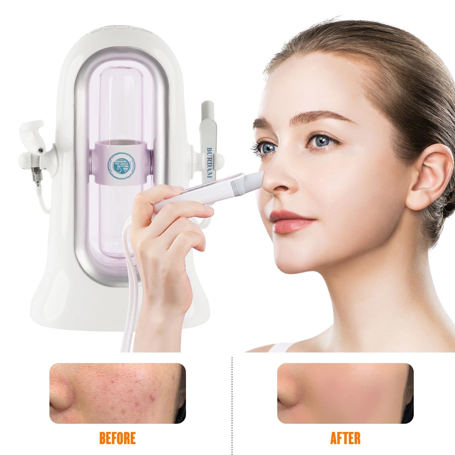 

Home Use Hydra Suction Blackhead Cleansing Moisturizing Oxygen Injection Instrument Aqua Peeling SPA Dermabrasion Beauty Machine