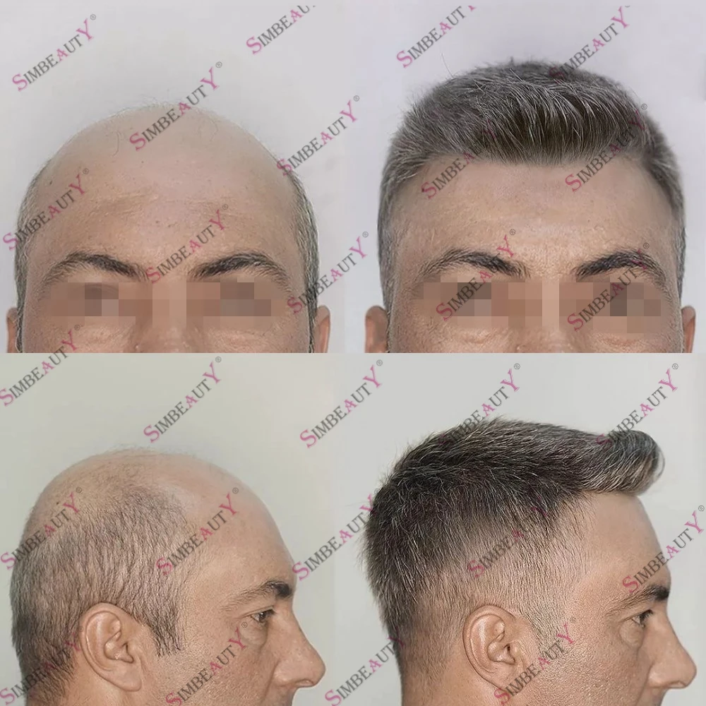 1B40 1B65 Men's Human Hair Toupee Hair Replacement System Capillary Prosthesis Natural Hairline Durable Fully Skin Base Mens Wig