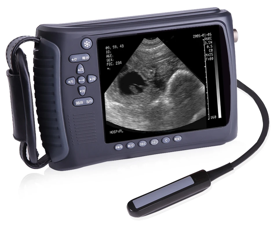 

SY-A015 Vet Ultrasound Machine 5" FTT-LED Veterinary Handheld Ultrasound Scanner