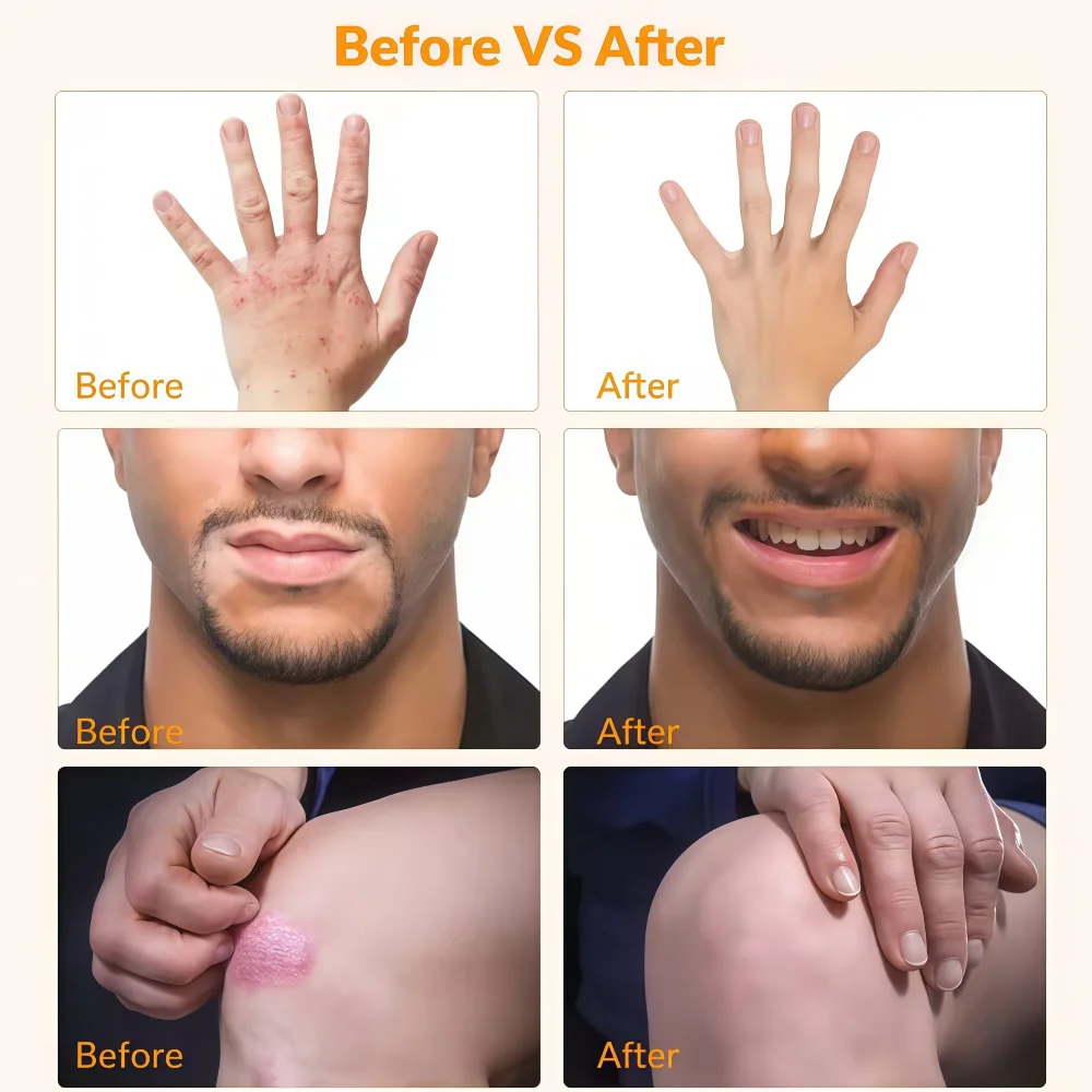 

Professional infrared laser physio Cold Laser Therapy Device for Pet Dog Cat Wound Injuries 650nm 808nm Home Handheld