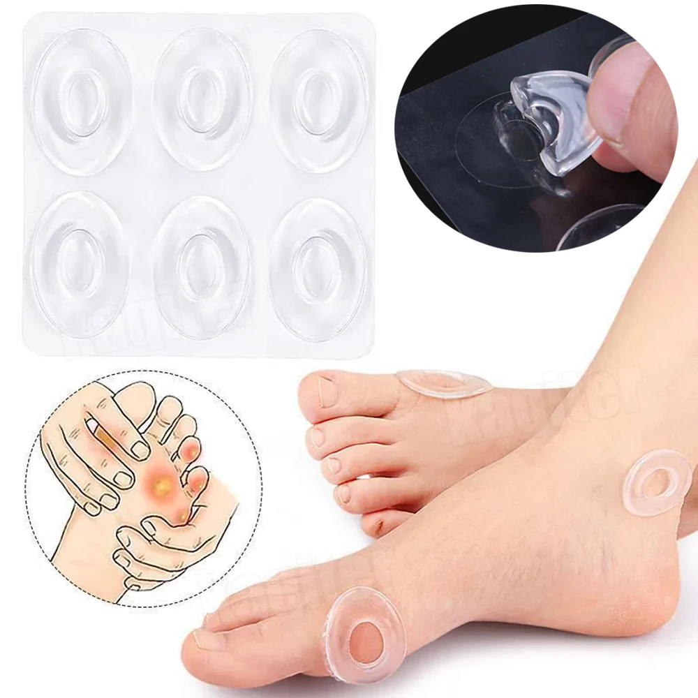 6 unids/hoja de Gel suave para pies, almohadilla de silicona para eliminación de maíz en el pie, parche para el ojo de pollo, cuidado de la salud, parche para calmar el dolor, cuidado de la salud