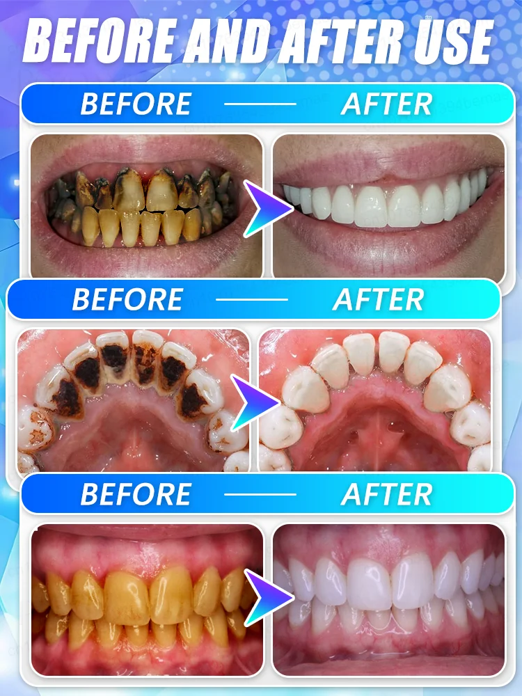 

Super whitening teeth, effective plaque cleaning, 2025 new technology mineral powder