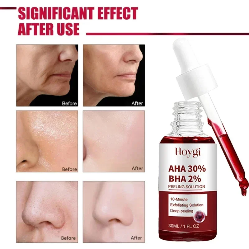 Pore Shrinking Serum Peeling Face ถอดรูขุมขนขนาดใหญ่กระชับ Repairing Facial Pore Minimizing ขัดผิวที่มีประสิทธิภาพ