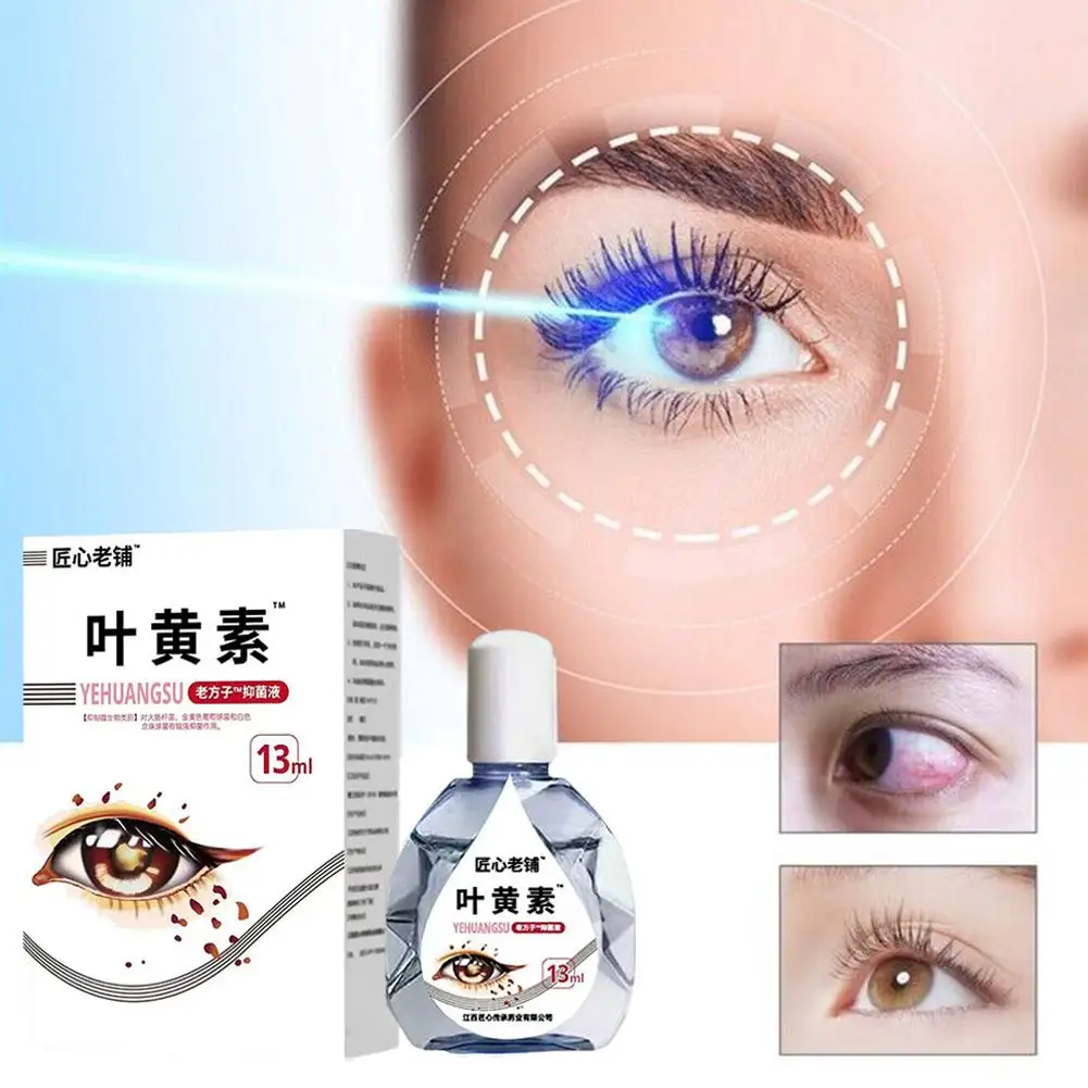 Lutein Eye Drops снимают усталость глаз, сухость, улучшают зрение, уход за глазами для теней, облачные размытые Vision Drops B6 для пожилых людей M5Q8