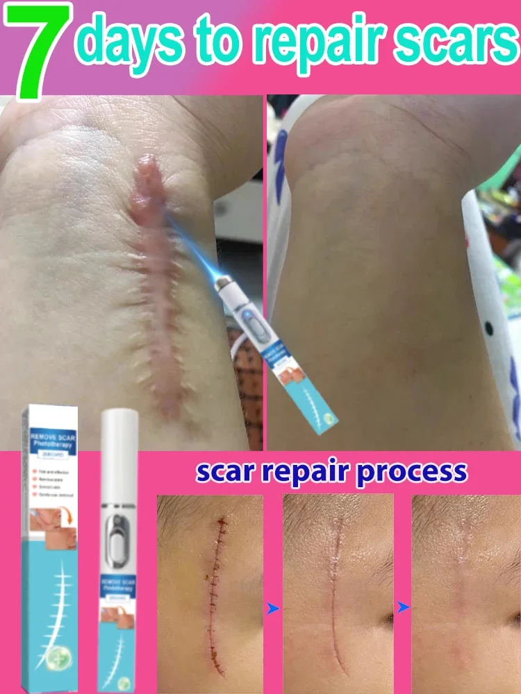 Repair scars and bring skin back to life