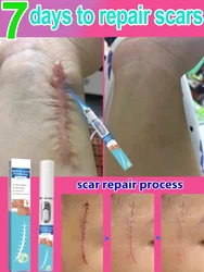 Repair scars and bring skin back to life