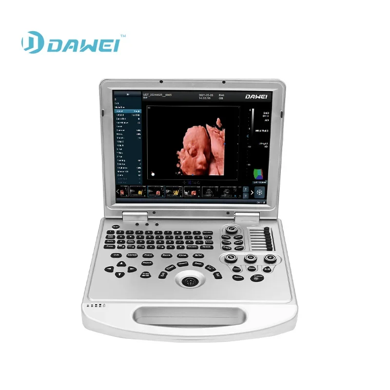 DW-L50 3D4D Real Ultrasound Diagnostic With Good Price Medicalultrasound Scanner Equipmentwith CE&ISO Certificate