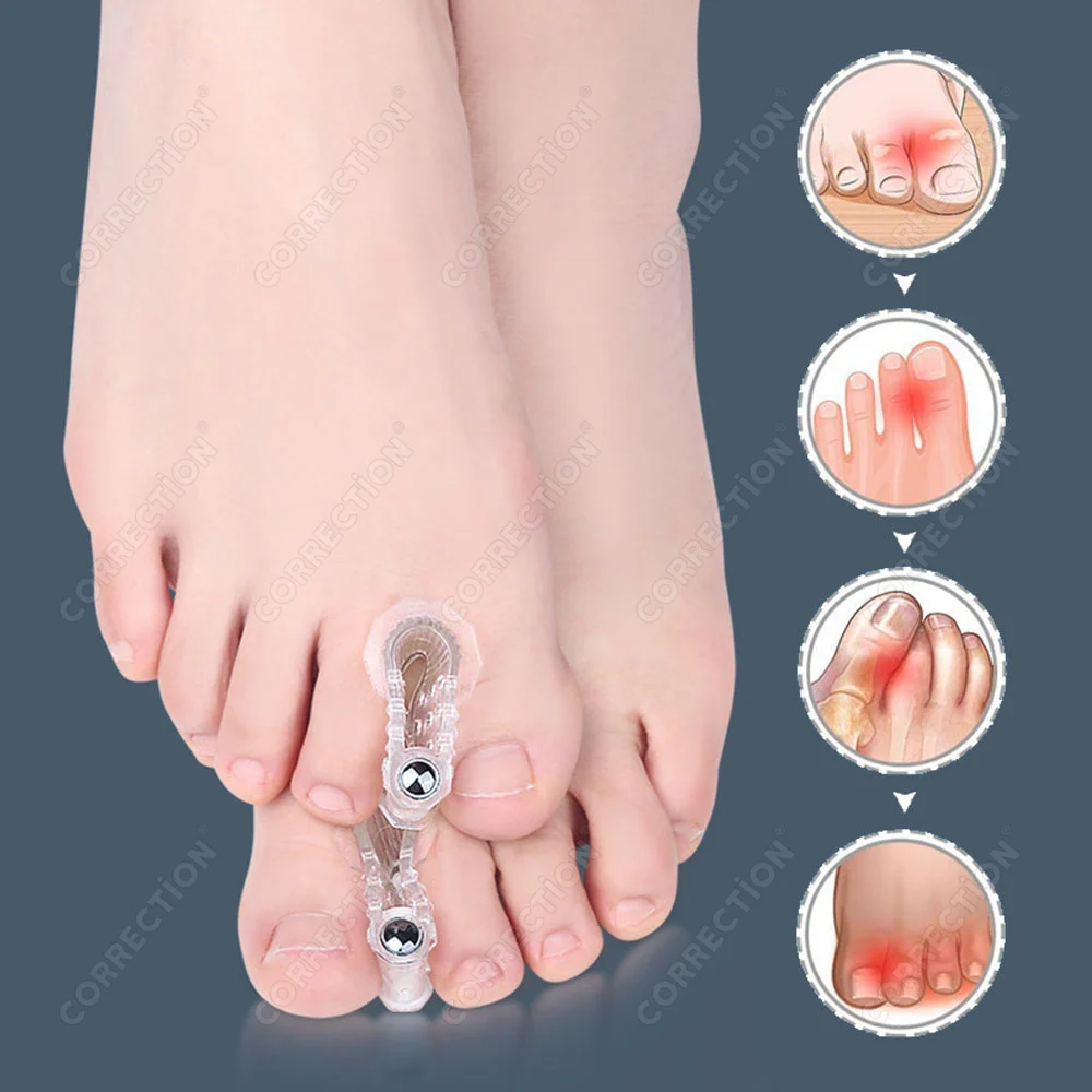 EiD Magnet Silicone Toe Protector Silicone Bunion Corrector Thumb Valgus Protector Nail Tools Foot Care Toe Separator Spreader