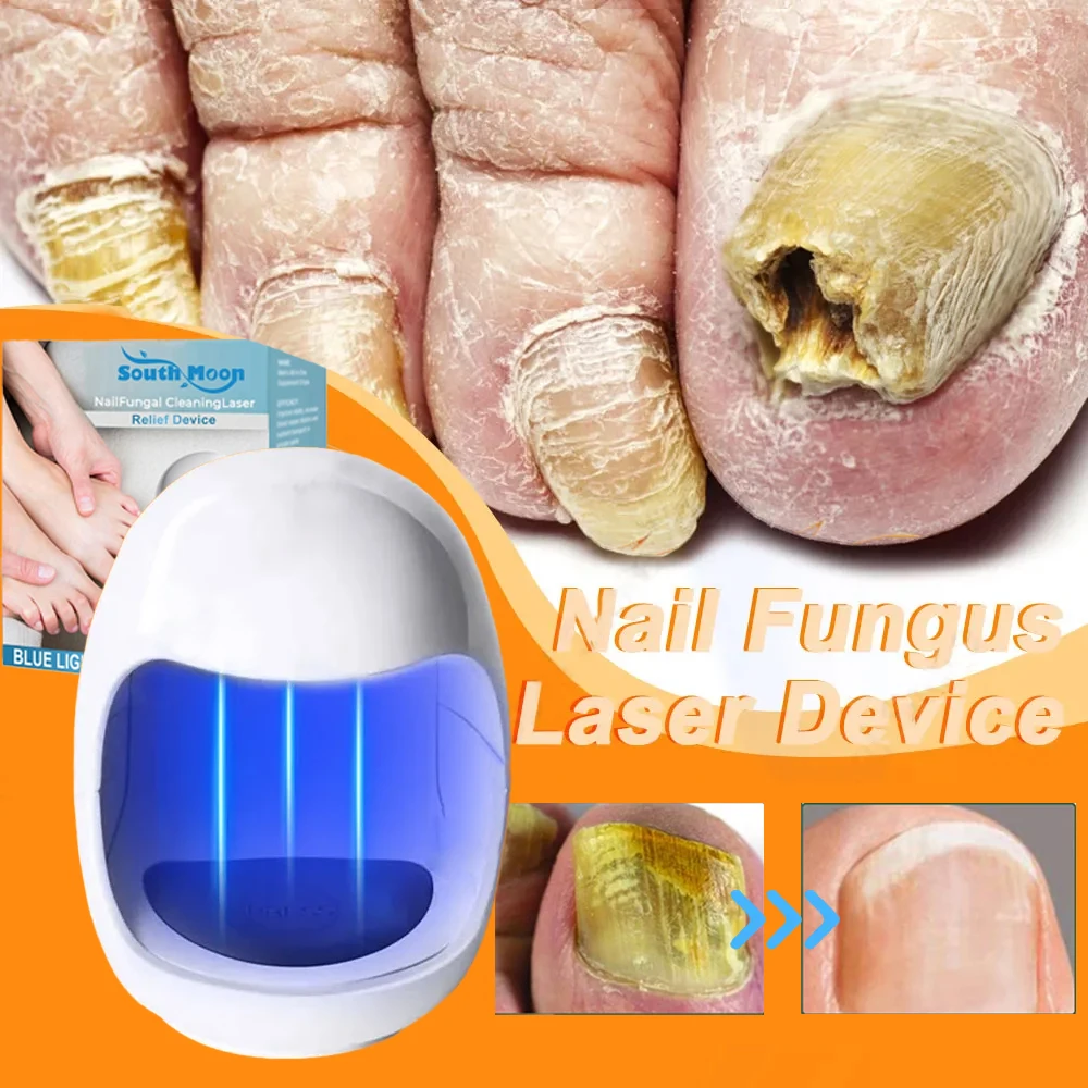 Dispositivo de tratamiento de hongos de uñas con láser, reparación de uñas encarnadas, Corrector de hongos de uñas, molde de Podología, uñas láser con hongos