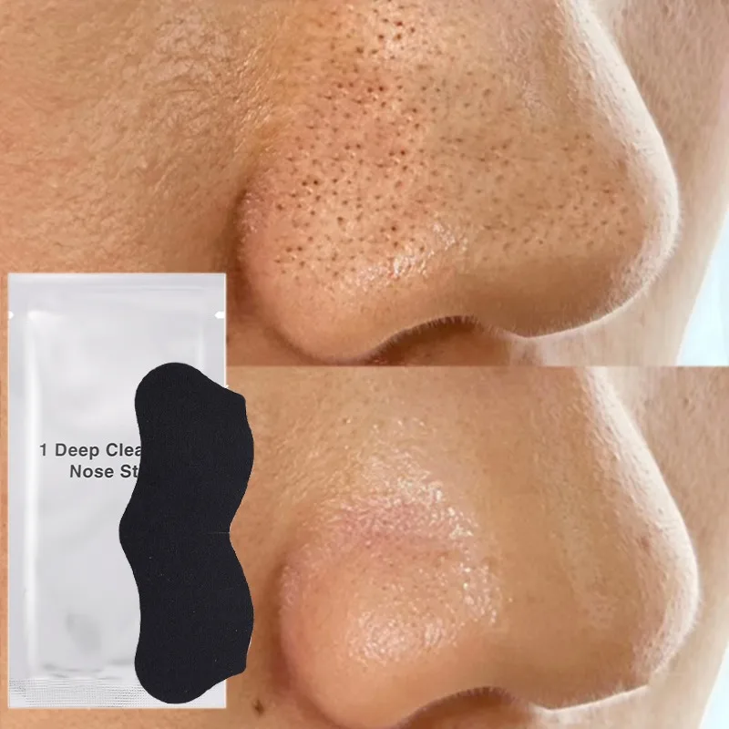 Deep Cleansing Nose Blackhead Remove Strips Shrink Black Dots Pore Acne Treatment Stickers Skin Care Peel Off Mask Patch Unisex