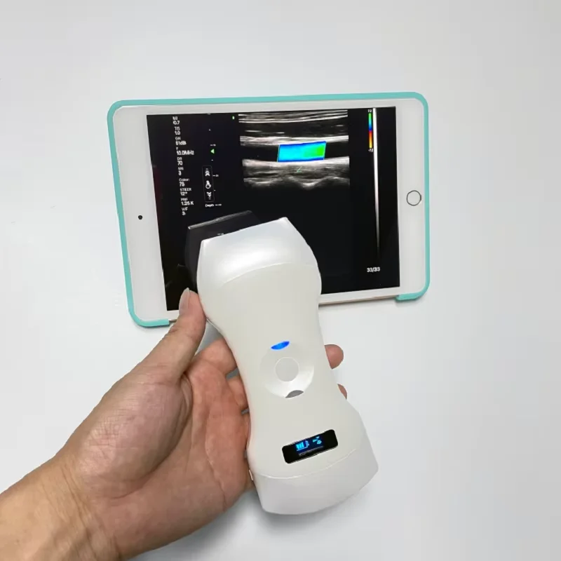 Рисунок 4 - Sonostar 192 элементов 3 в 1