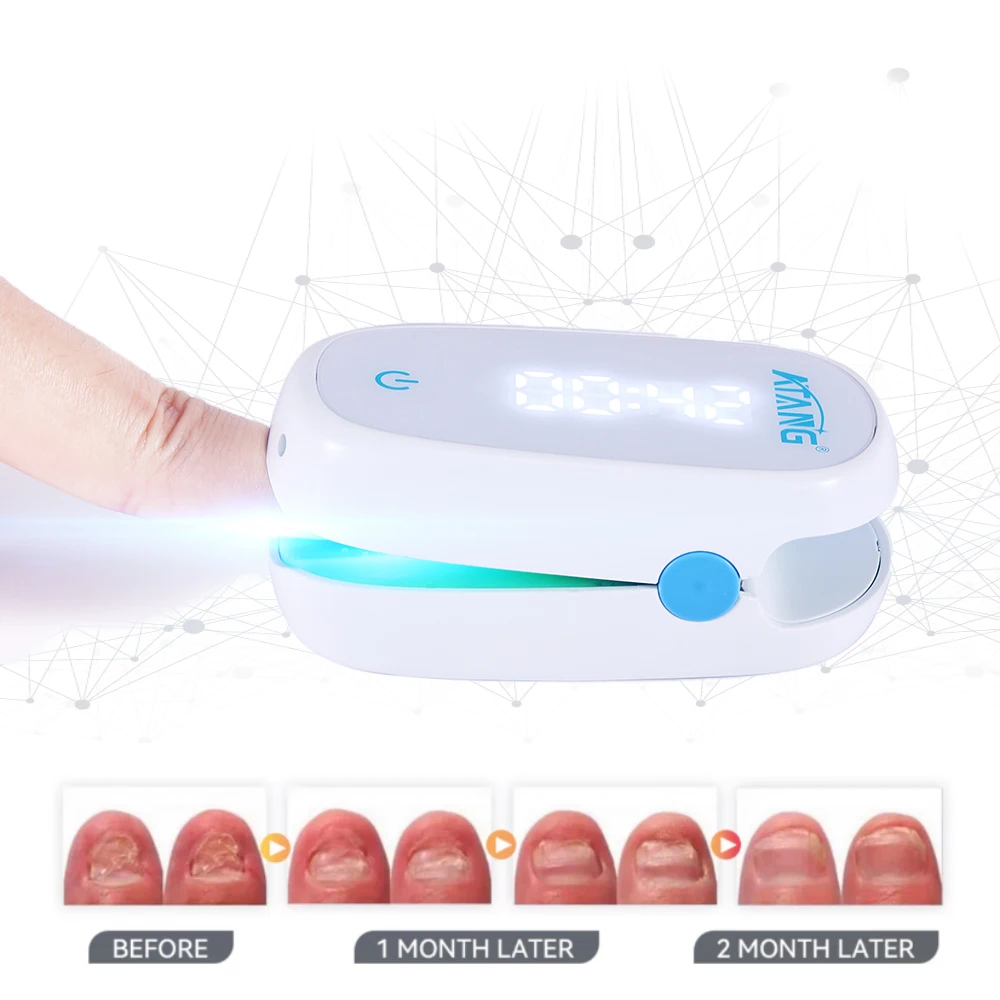 Nail Fungus Cleaning Light Device Onychomycosis Nail Treatment for Damaged Discolored Thick Toe Nails Toenail Fungus Remover