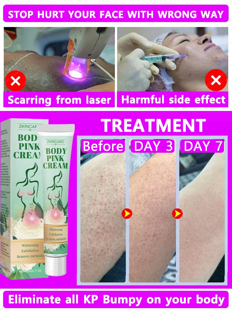 Exfoliating body lotion, repairs keratosis pilaris, removes goosebumps and strawberry legs