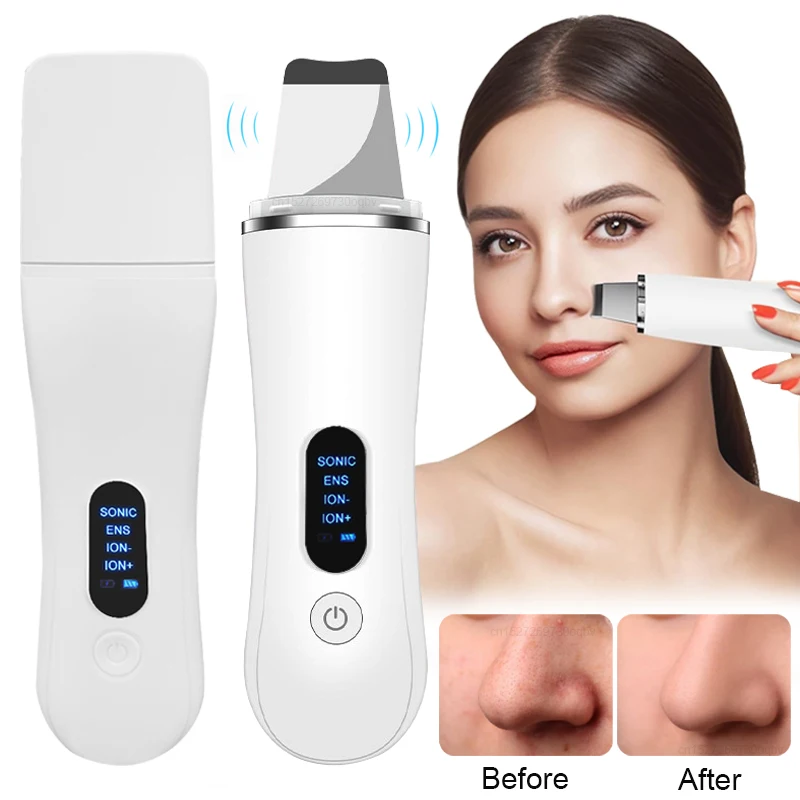 Ultraschall Haut Wäscher Gesichts Reinigung Spachtel Ultraschall Gesicht Wäscher Akne Poren Mitesser Entferner Ultraschall Schälmaschine