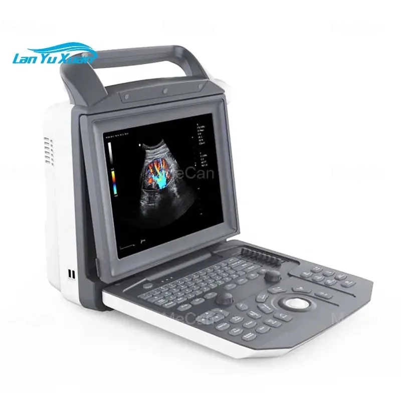 3D 4D Ultrasound Scanner Portable Medical Standard Prob Color Doppler Pregnancy Scan 4 D Ultrasound Machine