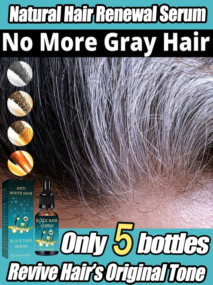 Revitalize Your Hair Color and Health with Anti-Grey Hair Natural Anti-Grey Serum Remedy  Healthy Essence Serum Treatment